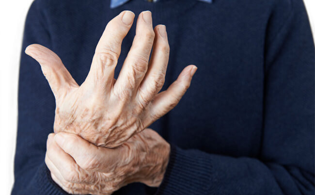 Rheuma | Arthrose | Arthritis | Gelenkschmerzen | Symptome | Anzeichen